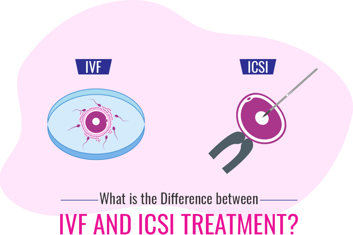 Ivf And Icsi Whats The Difference Kl Fertility Centre